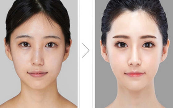 乾眼症患者中約60%是處於更年期的女性
